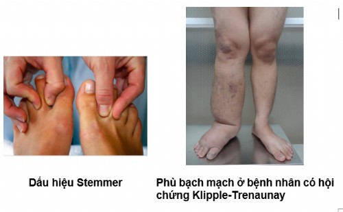 Phù bạch mạch